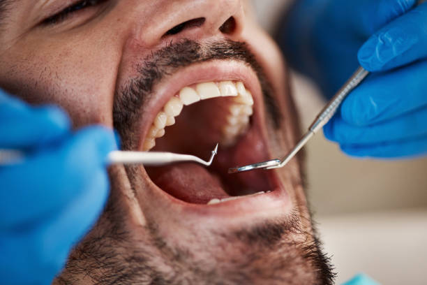 Best Tooth Pain Emergency Relief  in Albany, CA